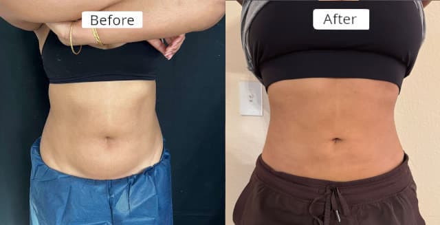 client2 - Before and After